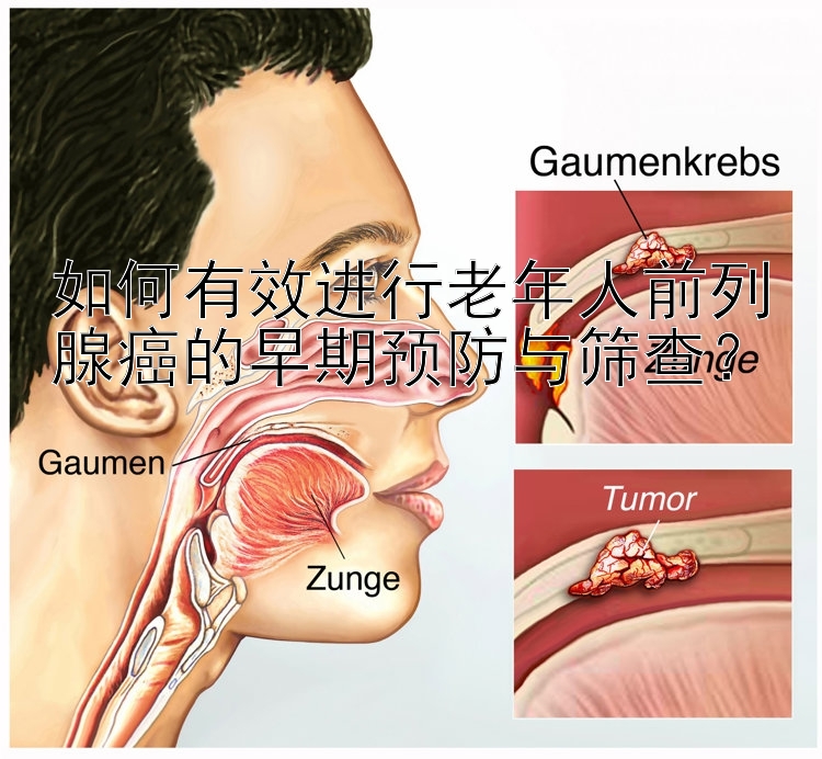 如何有效进行老年人前列腺癌的早期预防与筛查？